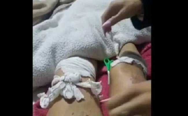 Gramado: Mulheres alegam estupro, agressões e que teriam sido jogadas em uma fogueira 1 estupro - Acontece Gramado