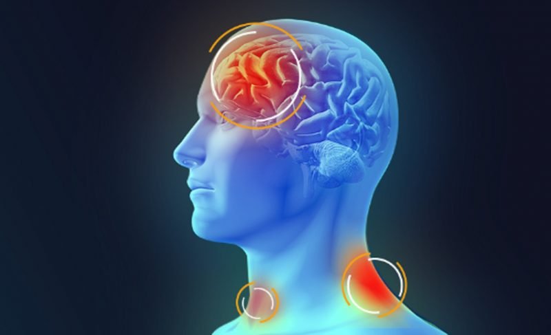 Morte de estudante em Canela por meningite bacteriana mobiliza área da Saúde 1 meningite 800x487 1 - Acontece Gramado